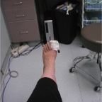 061109-BrokenToe
